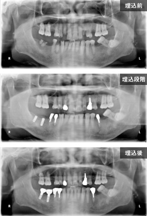 症例写真1