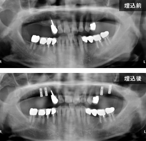 症例写真1