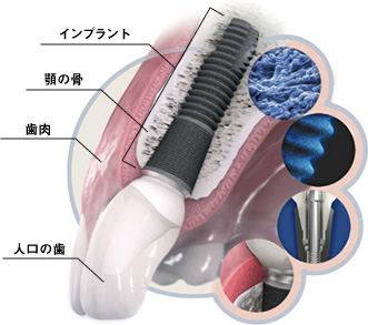 全世界で行われている最先端治療です。